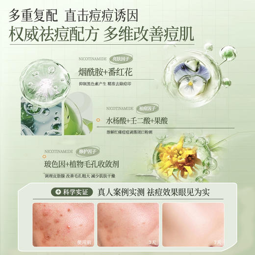 儒意复合酸焕颜次抛精华液30支/盒 水杨酸祛痘次抛精华液痘印痘坑修护淡化痘疤闭口粉刺黑头收缩毛孔|儒意官方商城 商品图2