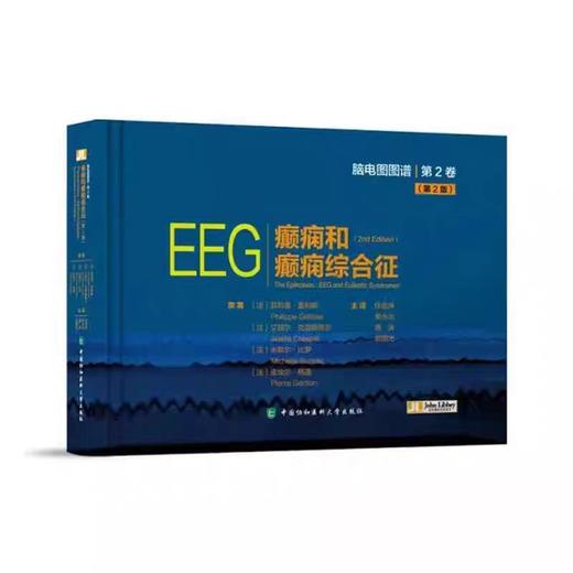 EEG癫痫和癫痫综合征 第2版 商品图0
