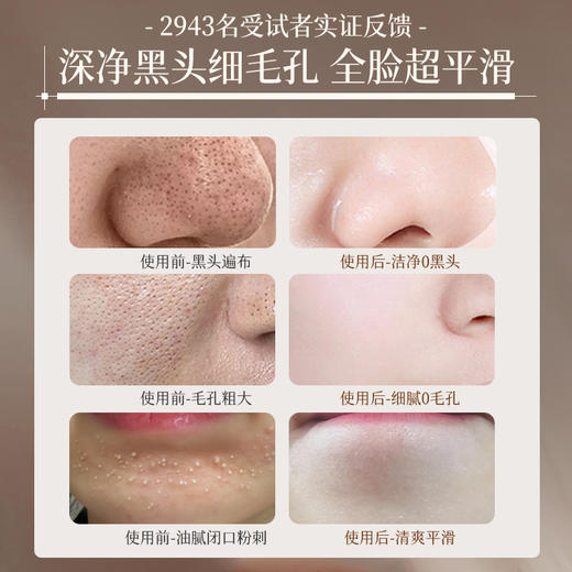 儒意清肌去黑头撕拉面膜150g 去黑头粉刺收缩毛孔深层清洁闭口草莓鼻控油|儒意官方商城 商品图2