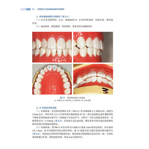 口腔修复学实验和临床操作训练教程 李江 吴哲主编 口腔科学 前牙全瓷冠的牙体预备及临时修复体制作 9787117373883人民卫生出版社 商品图4