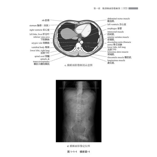 腹部影像解剖图谱 第2二版 周滟等 包括腹部断面影像解剖各脏器增强影像特点胆道影像解剖消化道 上海科学技术出版社9787547869246 商品图4