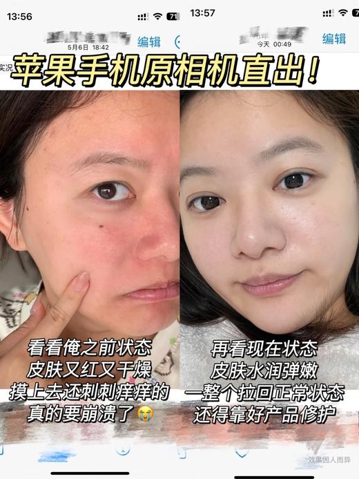 敷尔佳面膜奇亚籽滋养保湿修护贴舒缓补水滋润肌肤5片/盒 商品图6