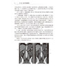 医学影像学读片诊断图谱 腹部分册 第2二版 肖文波 邓丽萍主编 用图谱的形式 简洁明了而全面地介绍影像技术的各种方法及临床应用 商品缩略图4