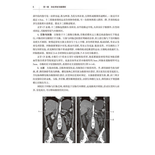 医学影像学读片诊断图谱 腹部分册 第2二版 肖文波 邓丽萍主编 用图谱的形式 简洁明了而全面地介绍影像技术的各种方法及临床应用 商品图4