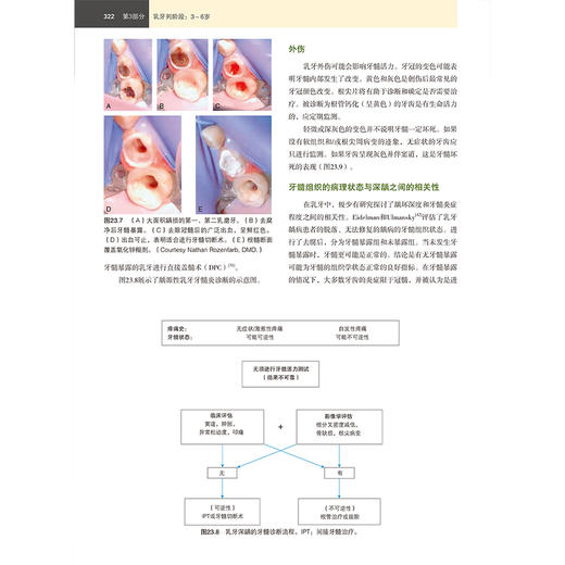 儿童牙病 从婴儿期至青春期 第6六版 阿瑟·诺介 学龄儿童口腔医学临床正畸修复牙周病牙体牙髓 辽宁科学技术出版社 商品图4