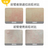 悦哺宝贝多效止痒舒缓乳30g 商品缩略图7
