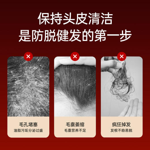 【赠育发液】笙观头皮彩光按摩健发梳 ，高频声波震动 梳头按摩 改善头皮环境 商品图1