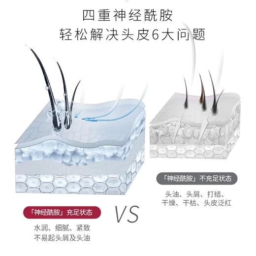 舒蕾头皮水润柔滑去屑洗发露700ml 商品图3