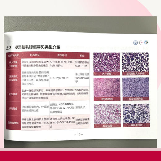 中国抗癌协会与中华医学会肿瘤学分会乳腺癌诊治指南与规范(2025年版精要本) 商品图5