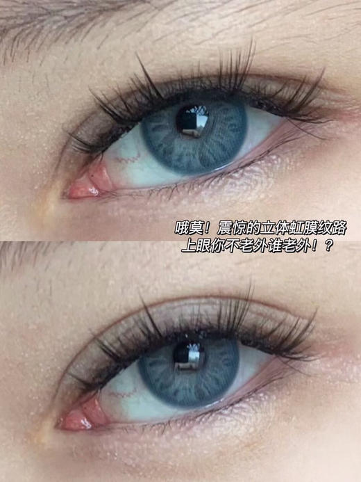 COCOCON蓝毒(佩戴直径:14.2mm) 商品图3