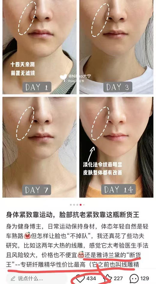 全新无盒中样，雅诗兰黛线雕精华15ml
速抢‼旗舰店30ml840。26年1-6月到期
2只就是30ml正装量，官网价值840元
咱们家两个15ml就是一个正装量 商品图12