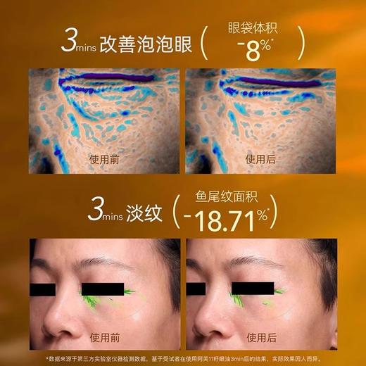 阿芙11籽淡纹紧致眼部精华油10ml/瓶 商品图5