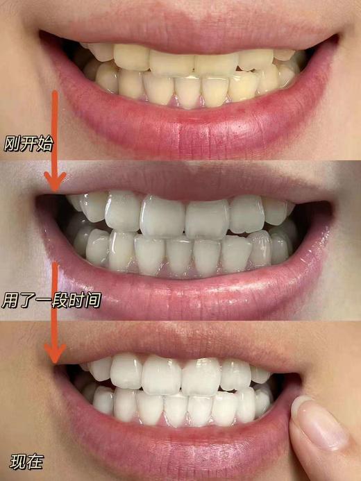 山姆屈臣氏热销爆款14天刷出大白牙AMAM 377专研益生菌牙膏系列 商品图14