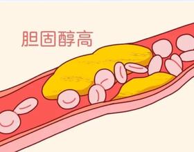  胆固醇“居高不下”？坚持这样做，血脂悄悄降 