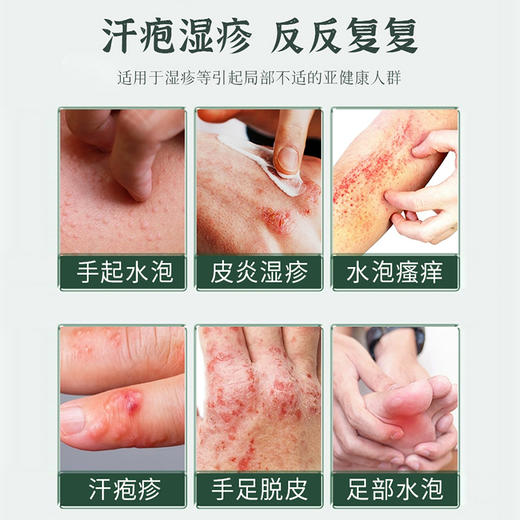 【小来】愈敏舒复方湿疹保健膏 植物中药配方 舒缓修复 温和安全不刺激 商品图1