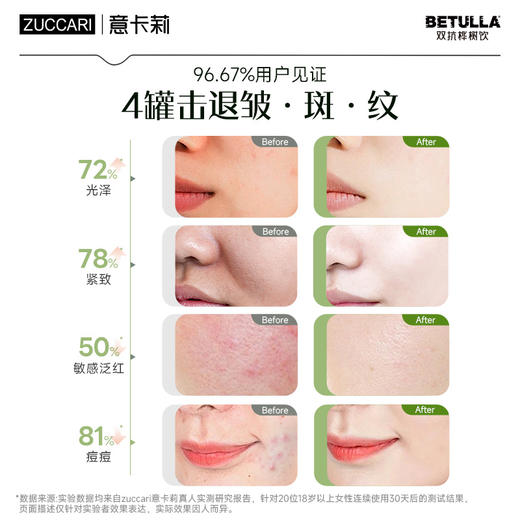 【重回少女肌】 ZUCCARI意卡莉 双抗桦树饮5罐装 商品图1
