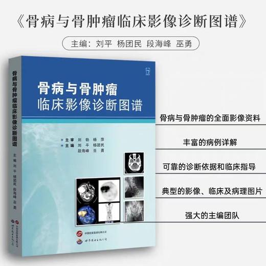 骨病与骨肿瘤临床影像诊断图谱 商品图0