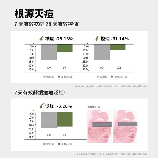 JVR杰威尔男士专用洗面奶祛痘控油去黑头洁面乳膏乳霜护肤品套装夏季 商品图3