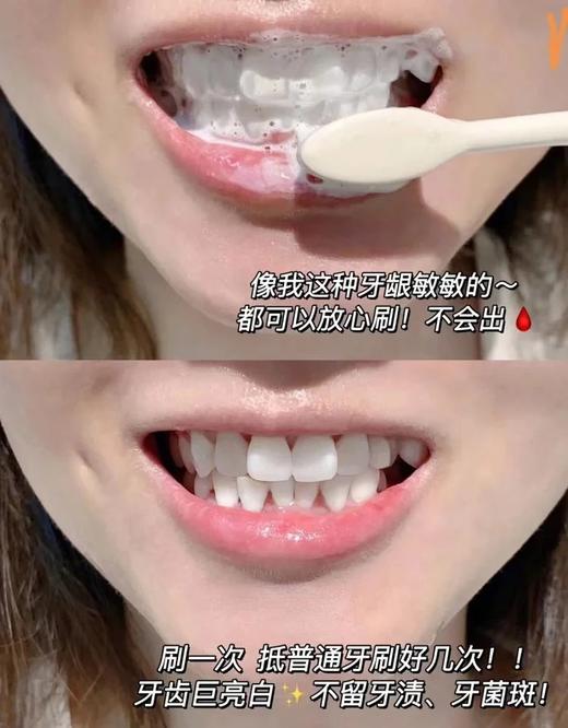 牙科医生推荐~特价亏清❗【瑞士怀尔德钻石粉牙膏75ml/支】瑞士90年专注口腔护理老品牌，品质在线✅蓝色钻石款日常用，抛光提亮~美白牙齿不是梦🦷 商品图3