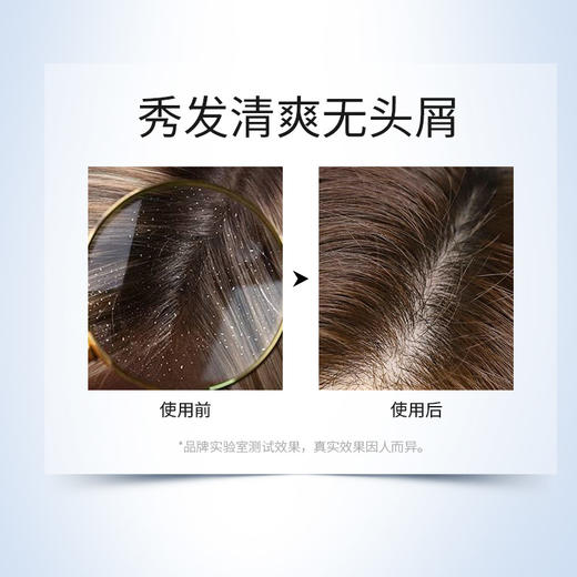 ACM爱诗魅 养发调理洗发水/清透洗发水/净透洗发水 商品图8