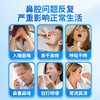 安泰宁鼻炎穴位贴压力刺激贴过敏性鼻炎鼻塞砭贴官方正品旗舰店 商品缩略图1