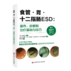 附实操视频 食管 胃 十二指肠ESD 操作 诊断和治疗基础与技巧 林香春 小野欲之 淹迟耕平 商品缩略图0