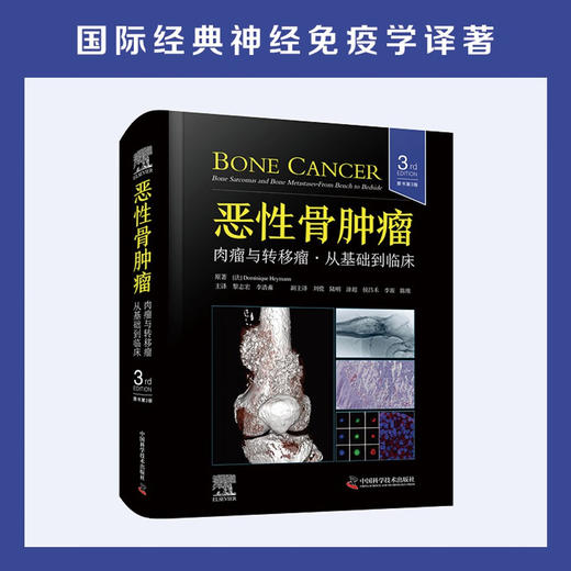 恶性骨肿瘤：肉瘤与转移瘤，从基础到临床（原书第3版）国际经典骨科学译著 商品图0