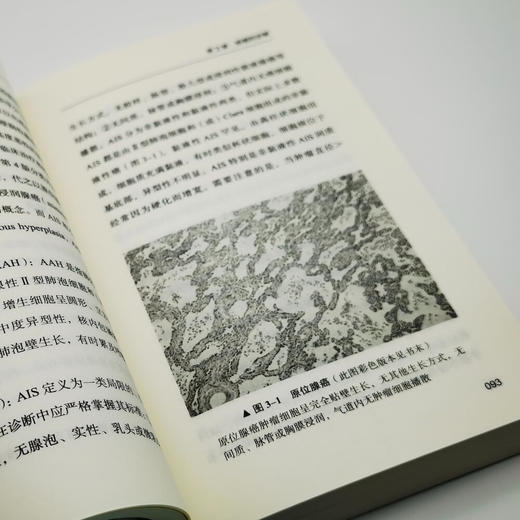 实用肺癌诊疗手册 商品图11