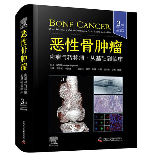 恶性骨肿瘤：肉瘤与转移瘤，从基础到临床（原书第3版）国际经典骨科学译著 商品图1