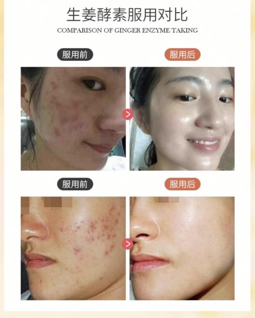 【清仓好价】日本Esthe Pro Labo植物酵素原液500ml（效期至25.8） 商品图3