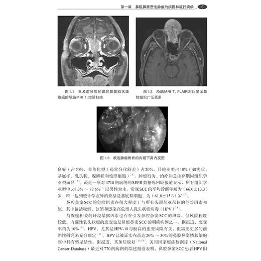 鼻腔鼻窦与颅底恶性肿瘤（中文翻译版）樊韵平主译 含鼻解剖学 病理学 肿瘤学和肿瘤综合治疗学的综合 可供鼻科医生等 科学出版社 商品图4