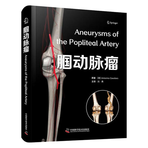 腘动脉瘤 国际经典血管外科学译著 商品图0