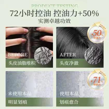 滋源清润蓬松控油洗头水535g 包装轻微磨损27年5月 商品图2