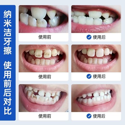 【纳米洁牙擦】成人儿童牙刷牙齿橡皮擦污垢清洁神器微洗黑牙菌斑去渍 商品图3