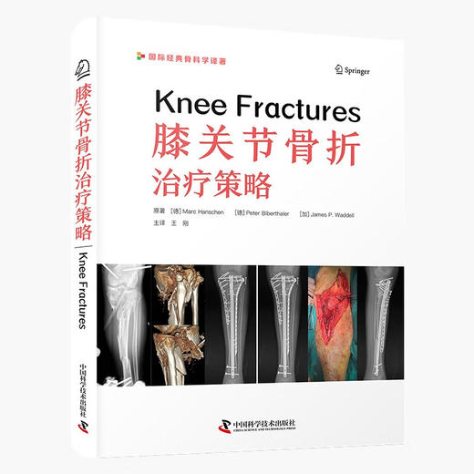 膝关节骨折治疗策略 国际经典骨科学译著 商品图0