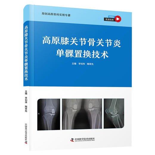 高原膝关节骨关节炎单髁置换技术（高清视频版） 原创高原骨科实用专著 商品图0