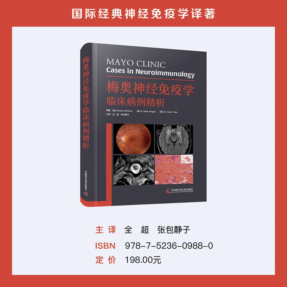 梅奥神经免疫学临床病例精析 国际经典神经免疫学译著