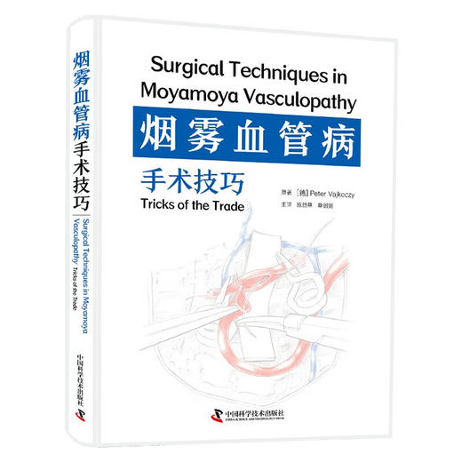 烟雾血管病手术技巧 商品图0