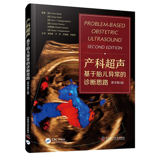 产科超声：基于胎儿异常的诊断思路（原书第2版） 国际经典超声医学译著 商品图1