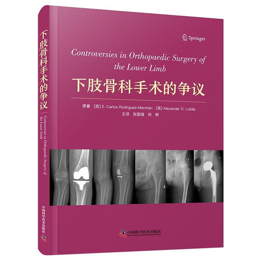 下肢骨科手术的争议 商品图0