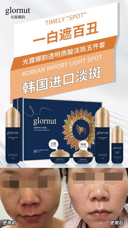 光露娜韵-美白祛斑套(glornut) 商品图3