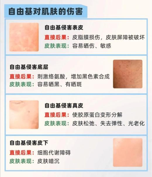 臻艾卡琳娜-白细胞极光逆龄水光精华液(3ml*100支) 商品图10