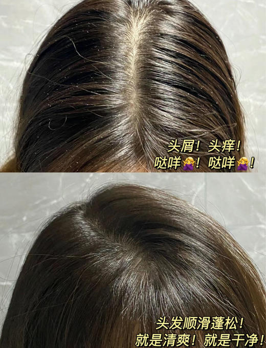 超好用！香香的！【德国🇩🇪Bioblas欧柏意洗发水、护发精油】防脱/舒缓/控油款！德国前3的医协认证品牌❗专业21年研究头皮问题👍深层清洁毛囊，头皮控油 🦠除螨！从此脱发、秃油头、头屑拜拜~ 商品图7