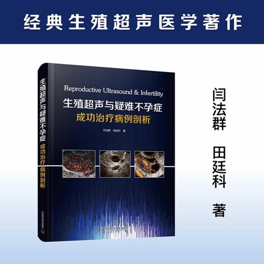 生殖超声与疑难不孕症成功治疗病例剖析 商品图0