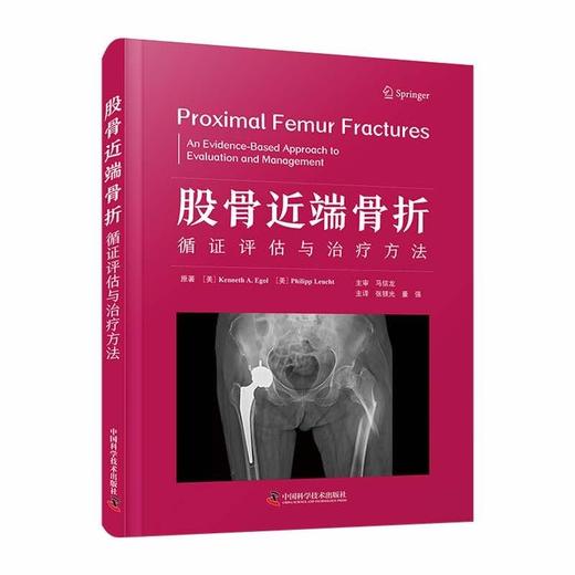 股骨近端骨折：循证评估与治疗方法 商品图0