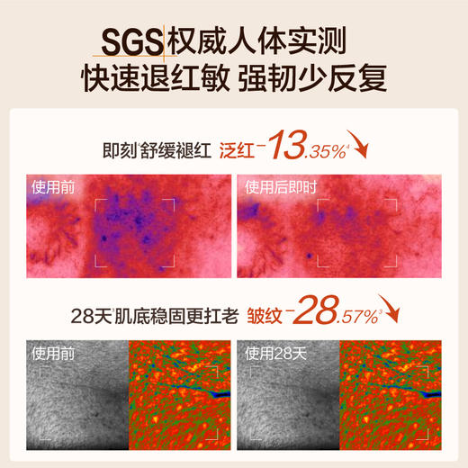 【新品上市】HBN小奶瓶修护水乳套装敏感肌紧致舒缓泛红强韧屏障 商品图3