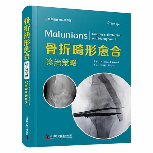 骨折畸形愈合：诊治策略 国际经典骨科学译著 商品图0