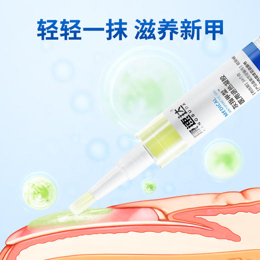 康速达灰指甲官方旗舰店正品冷敷凝胶医用退热凝胶甲沟炎趾甲 商品图4