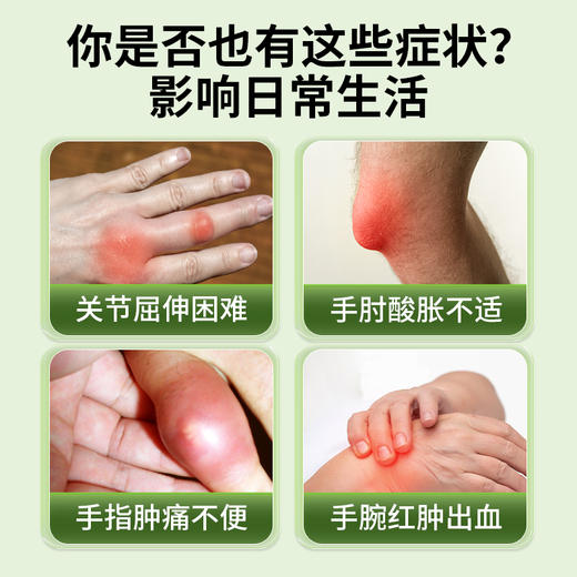 宝元堂腱鞘炎型医用疼痛凝胶手腕扭伤手指鼓包大拇指炎网球肘喷剂 商品图1