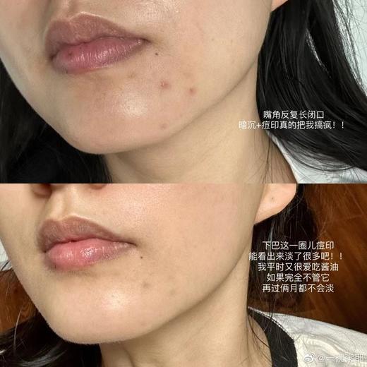 【清仓好价】优斐斯传明酸修护精华液3%经典款30ml（效期至26年后） 商品图1